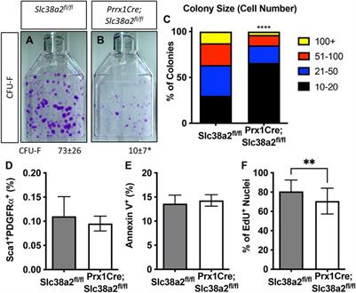 SLC38A2 provides proline and alanine to regulate postnatal bone mass accrual in mice